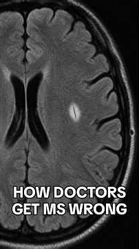 Christina Applegate's MS misdiagnosis: how doctors get MS wrong