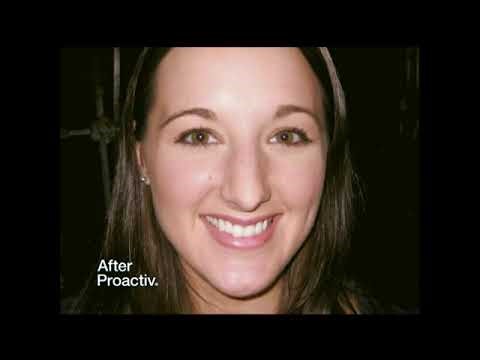 Proactiv TV Commercial Ft. Julianne Hough