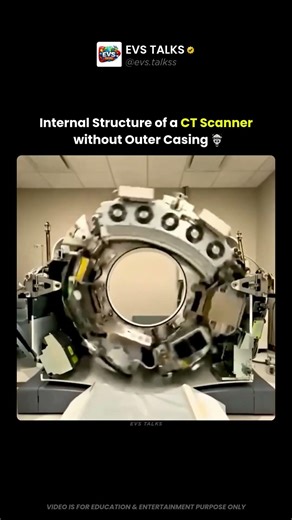 Inside a CT Scanner Without Its Outer Shell 😳🧠