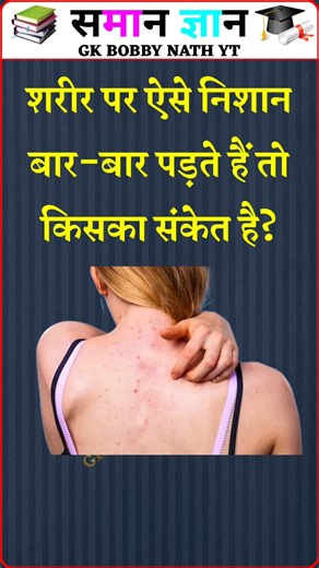 Top 20 GK Question🔥💯| GK in Hindi | GK Question and Answer #brgkstudy​ #gkinhindi​ #gk​ Part - 1249