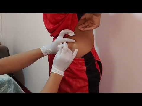 intramuscular injection The ONLY Safe Way to Inject: Glutes & Deltoids Step-by-Step