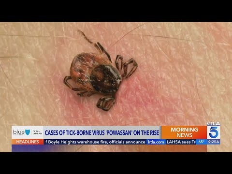 Rare but dangerous tick-borne virus on the rise in the U.S.