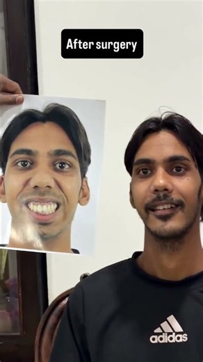 Post Ankylosis deformity patient - Transformation journey
