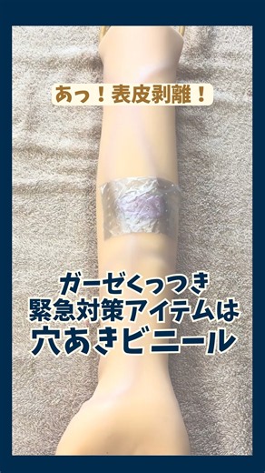 【表皮剥離】応急処置にキッチンの穴あきビニールを活用【訪問看護】