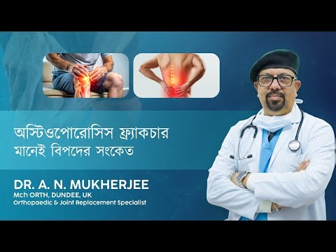 হালকা আঘাতেই হাড় ভাঙছে? সাবধান | Dr. A N Mukherjee | Med7 Clinic