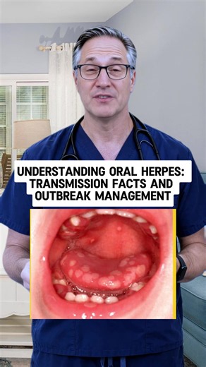 Understanding herpes simplex virus type 1 is vital for risk management. This virus remains dormant but can lead to painful outbreaks. Learn about transmission, safe practices, and awareness surrounding herpes. #Herpes #HSV1 #OralHealth #VirusAwareness #InfectiousDiseases