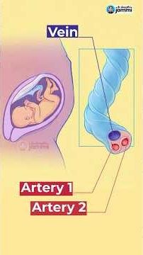 ⁉️👉Single umbilical artery – does baby grow normally? #pregnancy
