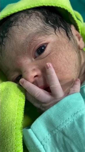 Painful Yet Beautiful Journey of Giving Birth to Twins👶💞 the Pure Magic #shorts #viral #motherhood