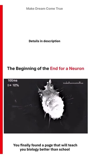 🧠 The Beginning of the End for a Neuron 🧬 | MDCT