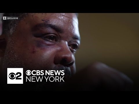 Brooklyn man injured in wrongful and violent arrest now planning to sue NYPD