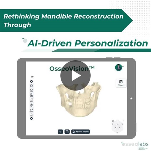 #oralandmaxillofacialsurgery #personalizedsurgery #aisurgicalplanning #osseolabs | OsseoLabs