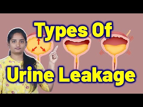 Types Of Urine Leakage, Overflow Incontinence | Leaking urine Homeopathy Medicine and Cure Surgery