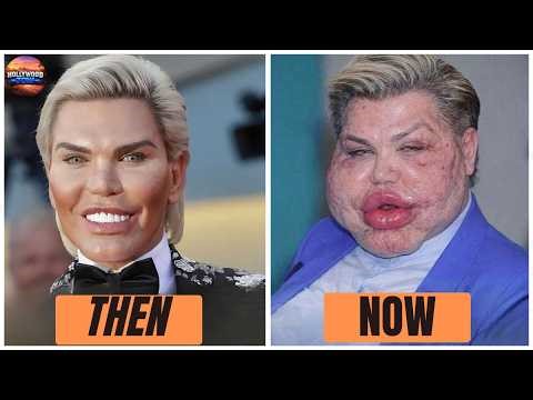 15 Celebrities’ Dramatic Plastic Surgery Transformations – The Truth Revealed | Then and Now 2026
