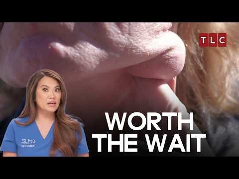 One Neck Lump Nearly Stood Between Him And The Stage | Dr Pimple Popper S4 E18 | TLC India