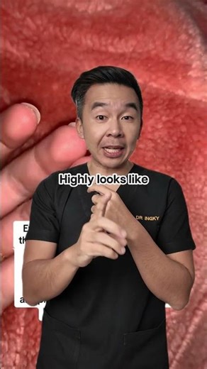 Flaky scalp isn’t always just dandruff 👇