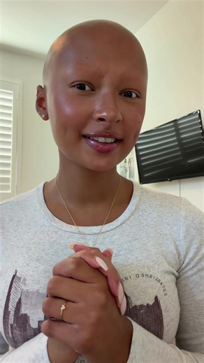 answering some of the most common questions i get asked about not having hair!! 🤗 | #alopecia #alopeciaawareness #kailiasa