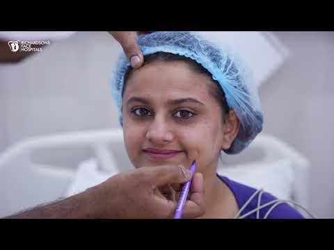 Beautiful Indian Girl Rhinoplasty Transformation | Before & After