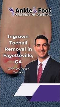 Ingrown Toenail Removal in Fayetteville, Ga | Ankle & Foot Centers of America