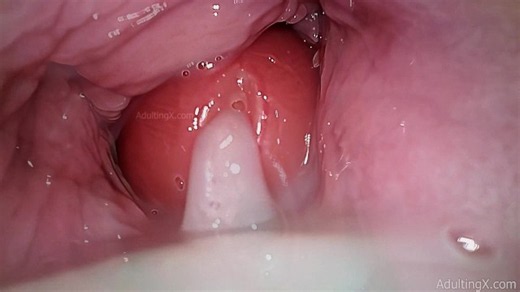 Cervix POV Creampie: Intimate Camera Inside — SakuraSins