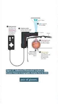 LogMAR and PRIMA Highlights in 90 Seconds
