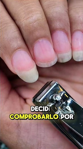 ¿Qué hay realmente dentro de una uña humana? 🔬 Lo que vi al microscopio me sorprendió