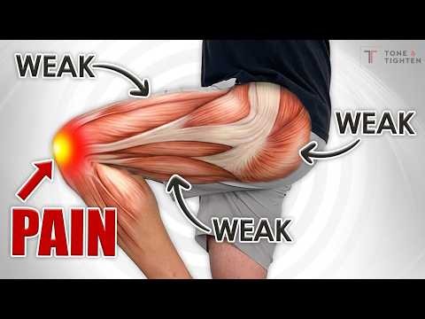 Fix Knee Pain For Good! [Strengthen These 4 Muscles]