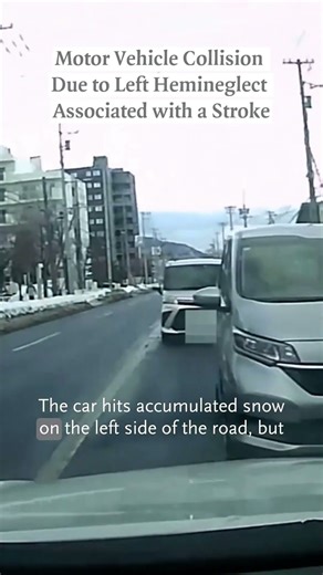 Images in Clinical Medicine: Motor Vehicle Collision after Loss of Reaction