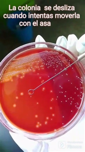 “Streptococcus pyogenes: del impétigo al laboratorio" #Microbiología#Streptococcus #Impetigo