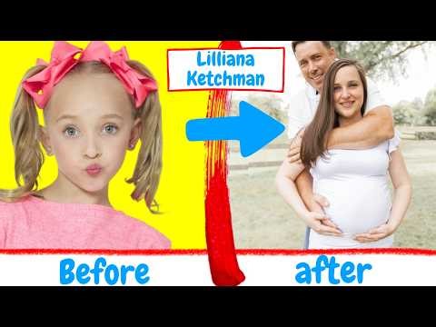 Dance Moms BEFORE And AFTER | Abby Lee Miller 2026