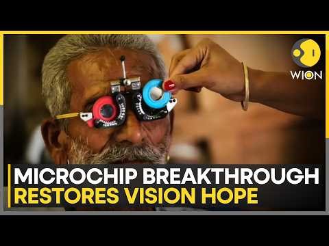 Bionic Eye Breakthrough: Microchip Restores Vision in AMD Patients | WION