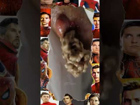 Blackheads Removal | Acne Treatment and Very Satisfying Satisfying Pimple pop #blackheads