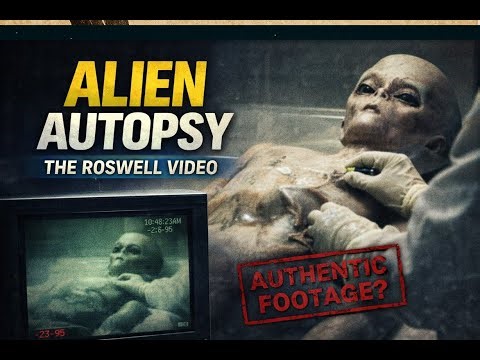 Alien Autopsy Footage Examined — The Roswell Video That Still Defies Explanation