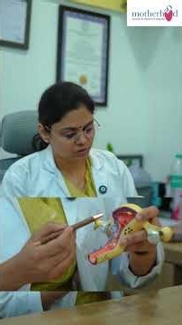 What Treatment Options Are Available for Fibroids? | When Do Fibroids Need Surgery?