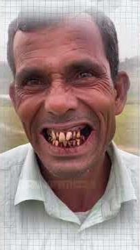 Teeth Dissolve In Tobacco #bluebox