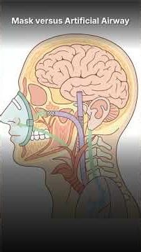 Invasive vs Non-Invasive Ventilation #criticalcare #icu #nclexstudyguide #nclex #nurses #nursing