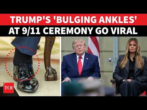 Trump’s 9/11 Health Scare: Ankle Swelling, Drooping Face Trigger Massive Firestorm Before Midterms