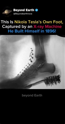 Nikola Tesla X-Rayed His Own Foot in 1896! ⚡🦶🤯