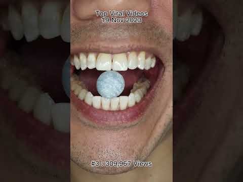 Satisfying Chewing ASMR #Compilation #ASMR #DoctorTristanPeh