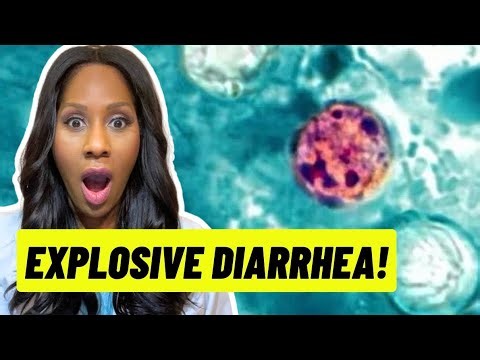 Explosive Diarrhea Stomach Infection: Cyclospora (Cyclosporiasis) Symptoms, Diagnosis & Treatment