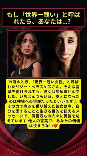 17歳で「世界一醜い女性」と呼ばれた少女…信仰で痛みを乗り越えた感動の実話✨