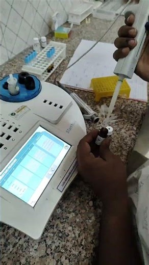 “PT & APTT Test | Blood Coagulation Profile | Lab Procedure Explained”