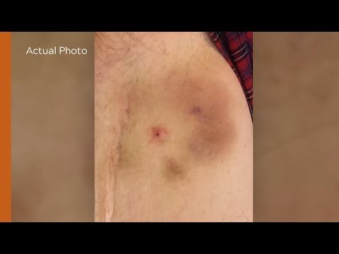 Are Aliens Implanting Humans? | Encounter UFO 108