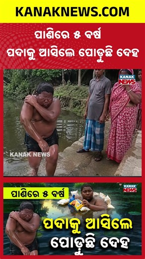 Water Shock: Body Burns Whenever Water Touches Him for 5 Years!