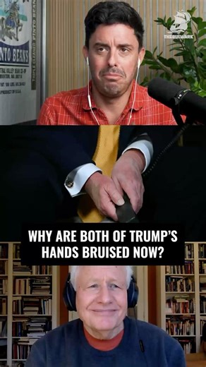 "The bruise has expanded to the left hand."