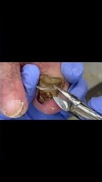 Watch This Incredible Nail Transformation