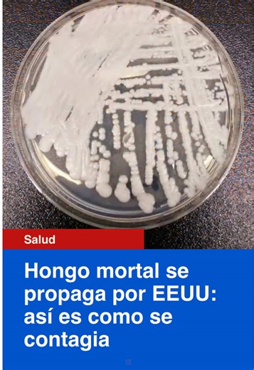 🍄‍🟫 Hongo mortal se propaga por EEUU. Estas son las principales vías de infección. 📺 No te pierdas el Noticiero Univision Edicion Digital de lunes a viernes a las 12pm/11C por Univision. #Salud #Hongo #EdicionDigital