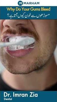 Why Do Your Gums Bleed | Masoodhon Se Kiun Khoon Ata Hai