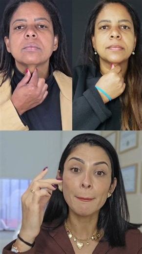 PDO Threads or Bio-stimulators: Which is Best for a Facelift?