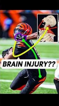 Doctor explains Ja’Marr Chase Traumatic Brain Injury (Concussion)