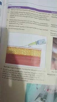 TEN SHOT SERIES FOLLOW INTRADERMAL INJECTION RIGHT WAY BALVEER SIR